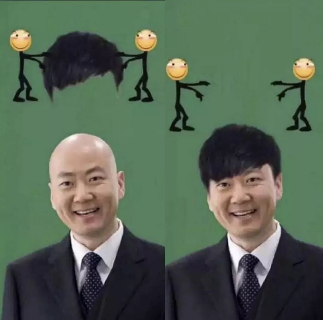 更何况,郭冬临和林俊杰之间都只差一顶假发,难怪林俊杰之前的造型都