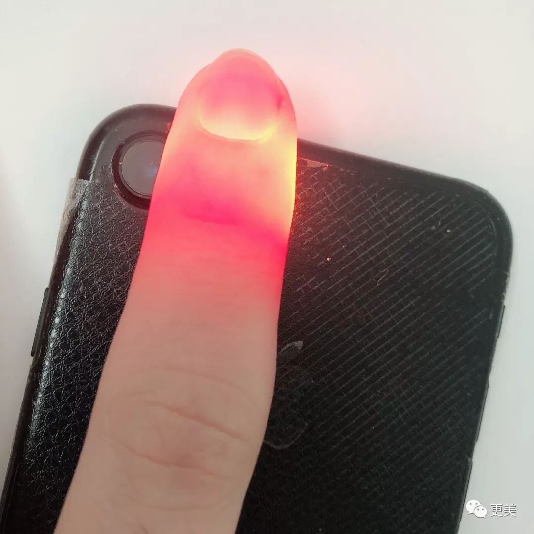 强光会穿透手指发红,甚至呈半透明,跟鼻透光的状态一样