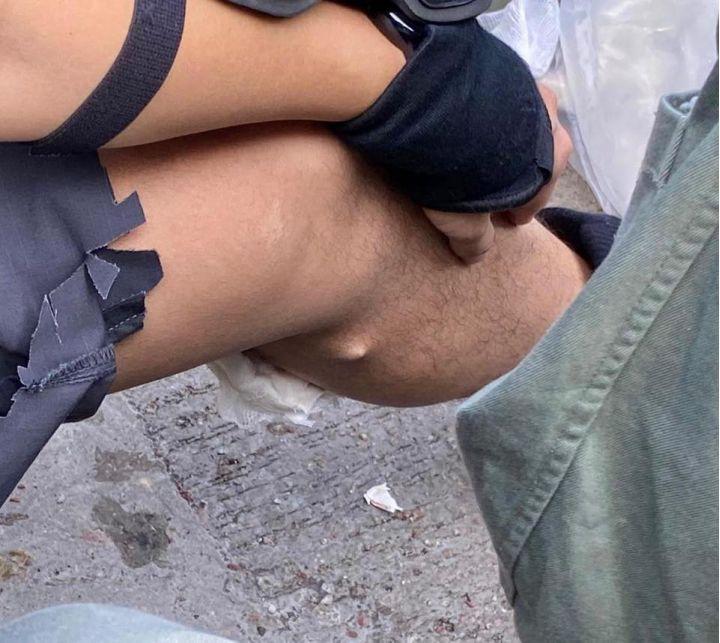 (警察传媒联络队一队员被箭射中小腿，图源：香港警察脸书)