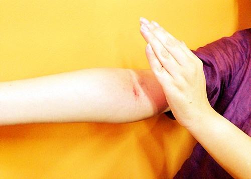 老人如何经络拍打才安全?