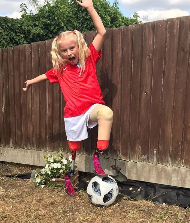 7岁无腿女孩一夜刷屏朋友圈,生来残缺,备受欺凌,她却做了一个这样的