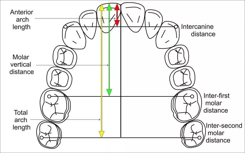 郑爽|牙齿|托槽_新浪新闻