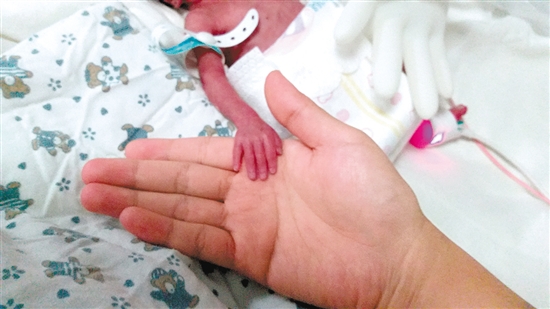 生命奇迹"超早产"双胞胎双双存活