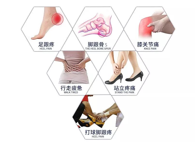 脚掌疼,跟腱炎和足底筋膜炎▲"跑步膝"膝盖损伤长此下去会造成跑步膝