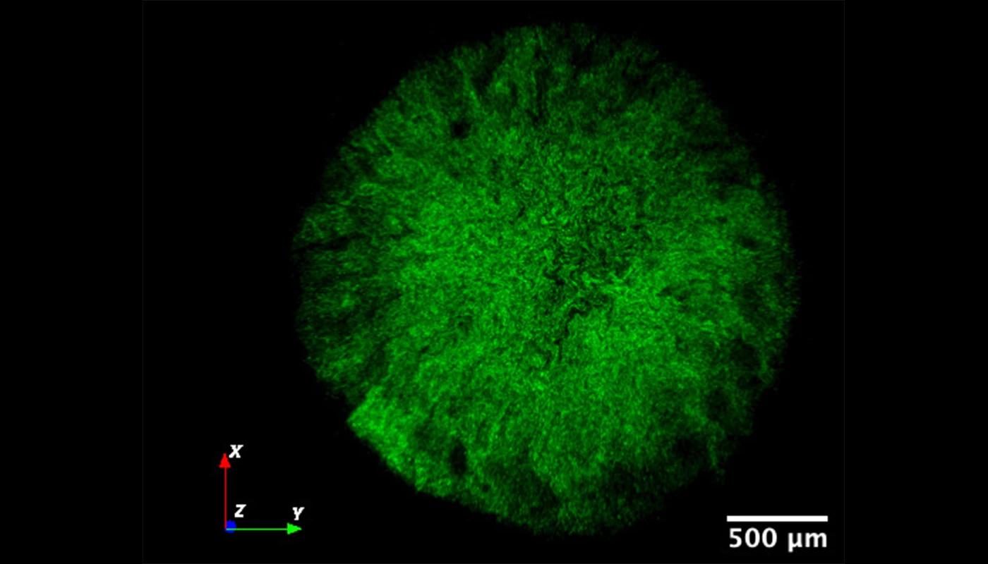 科学家发现细菌生物膜的死星式弱点