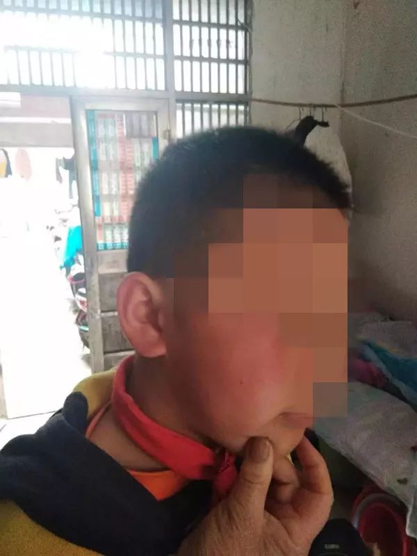 没考好就被老师打肿脸,能不能这样管孩子?网友吵翻了