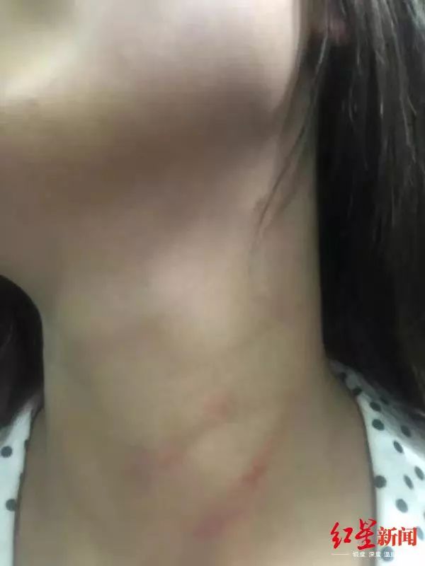 26岁女教师与丈夫深夜打斗后坠楼身亡！警方通报：不予立案