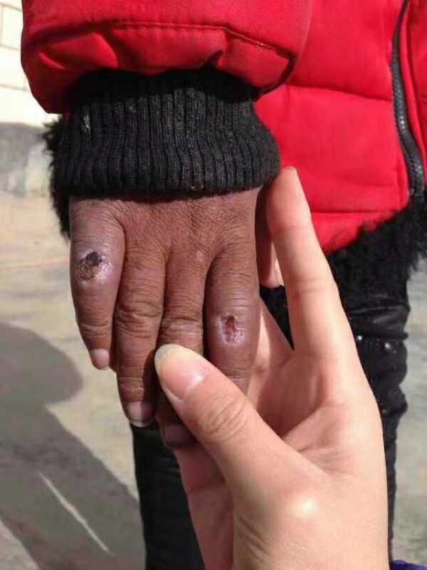 冻得像一根根"烂胡萝卜"小小的手指他们握笔的手经常会被冻僵一边哈气