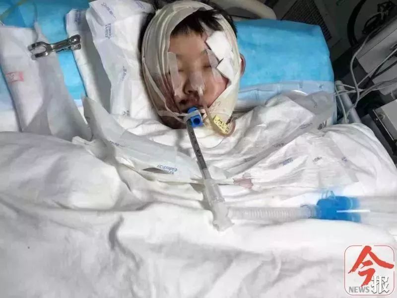 经抢救无效不幸离世……卢明华因伤势严重1月12日凌晨,噩耗传来全身多