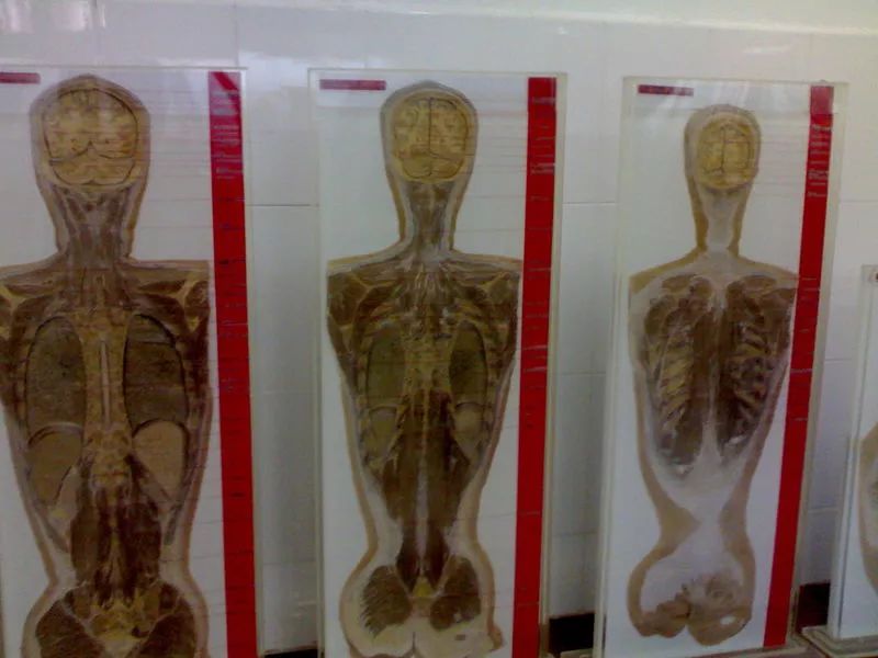 他们没有感觉和思想,但数据来自真实的人体切片.