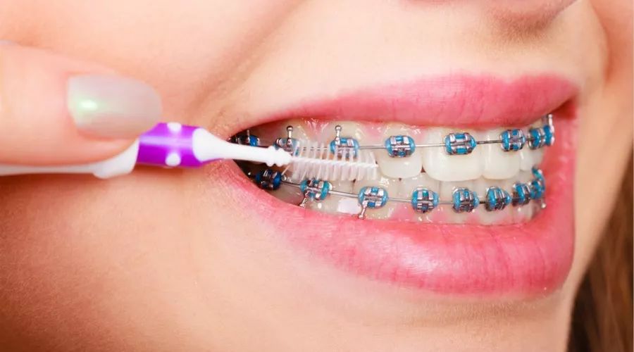 这个刷牙动作伤牙齿,很多人还在用