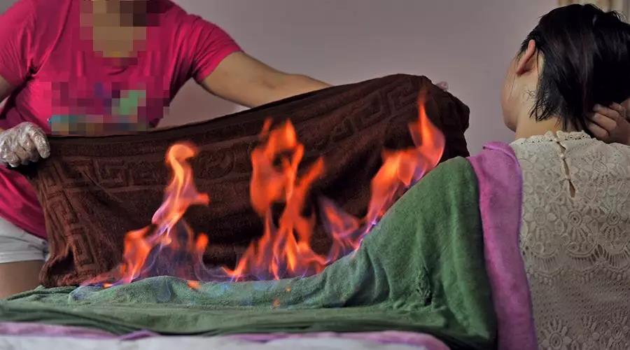 一位店员正在给客人做火疗