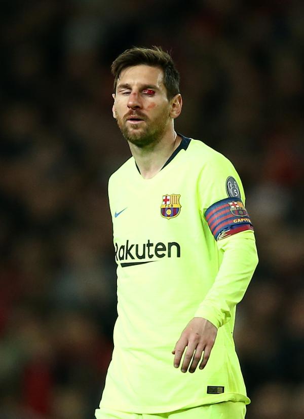 曼联0比1巴萨,梅西血染赛场…这场经典对决成