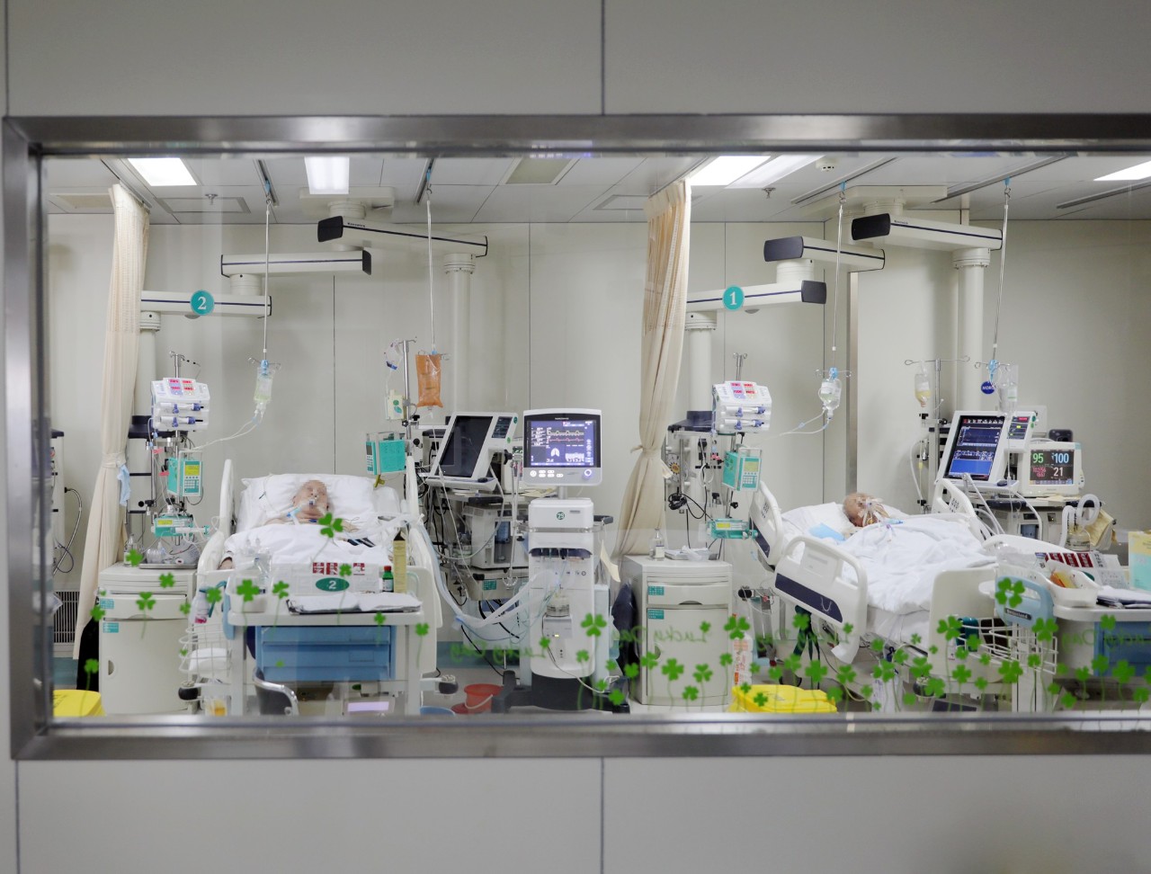 市人民医院icu让气管切开患者脱离呼吸机开口讲话