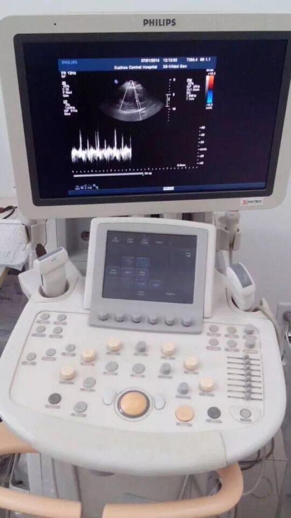 超声检查的安全性与 x 线及 ct 检查不同,至今尚无有关诊断性超声检查