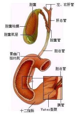 说:小宇的胰腺炎是因为先天性胆管扩张——胆总管囊性扩张所引起的