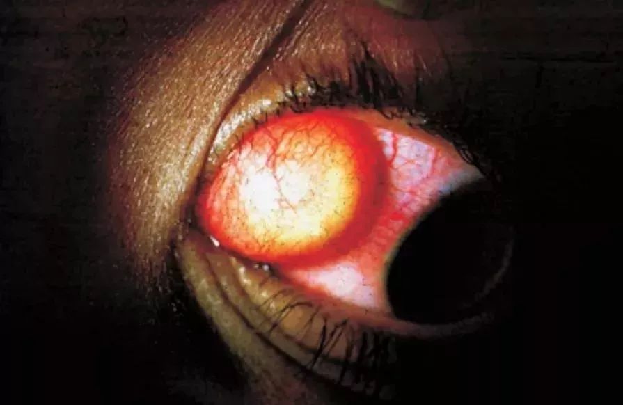 减肥|整容|蛔虫_新浪新闻