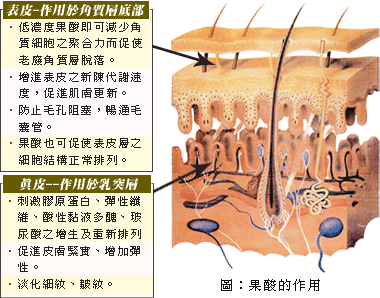 刷酸是烂脸还是换脸7个干货告诉你这不是危言耸听ad