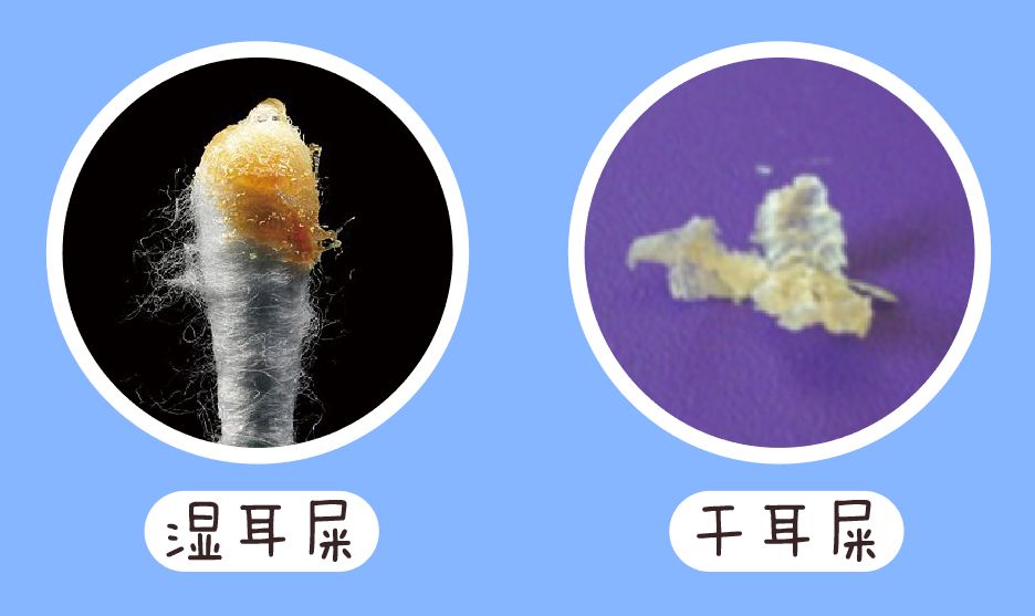 给娃上医院掏耳屎花了5000块平时注意这个就能避免