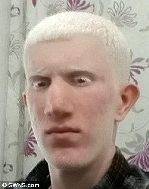 21岁白化病少年骑自行车被撞 恐怖瞬间被摄像机记录下来