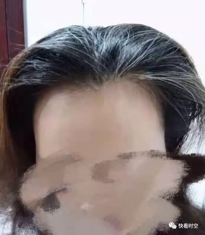 〡健康集中营〈有白头发怎么办?