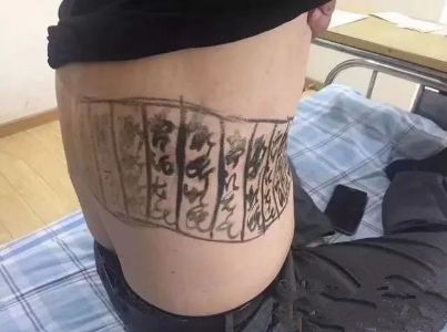 这纹身有点社会啊……原来他是听信了所谓的"土方子"为了治疗"蛇缠腰"