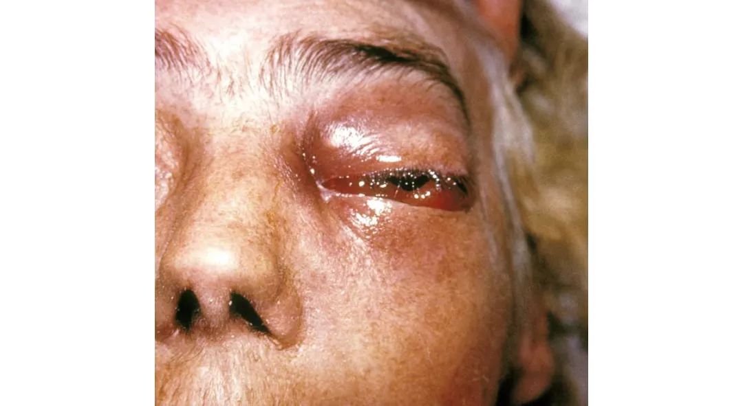 你爱的腐乳里,少不了这个神奇的小东西