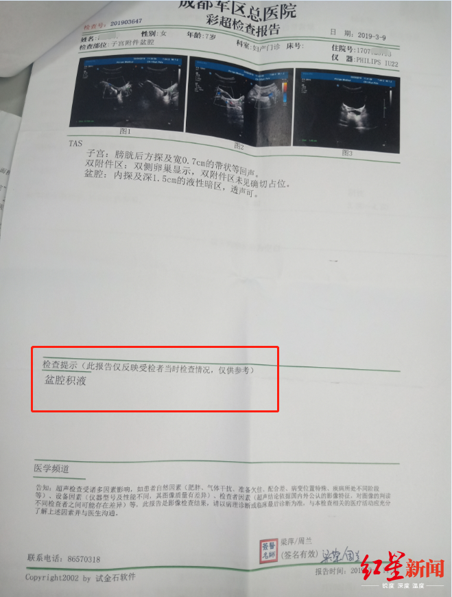 而在今年3月9日的化验单中,诊断结果显示为盆腔积液.