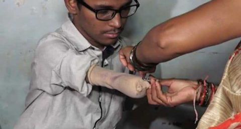 印度男孩因电击失去双臂双脚,把笔固定在断臂上写字考出好成绩