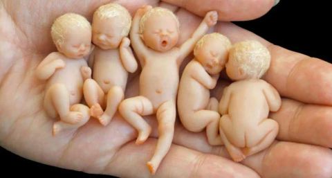 世界上最小的婴儿!只有拇指大小 捧在手里心都萌化了