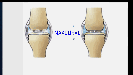 轻轻一抹,10分钟竟缓解颈椎疼,肩周炎,膝关节疼痛!
