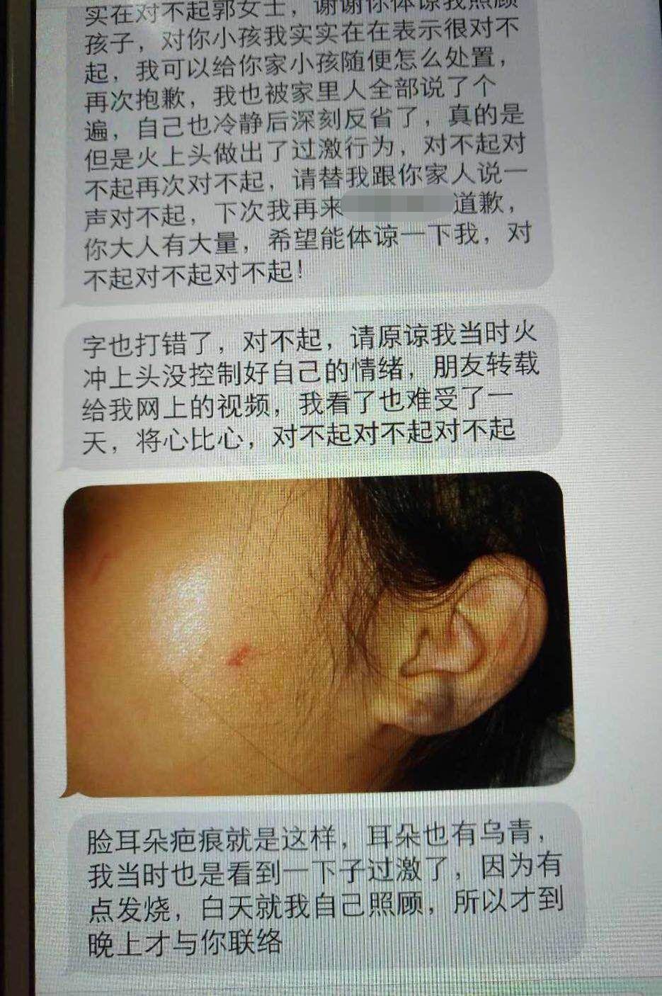 4岁女孩被女子凶狠掌掴看得揪心 打人者已被行拘