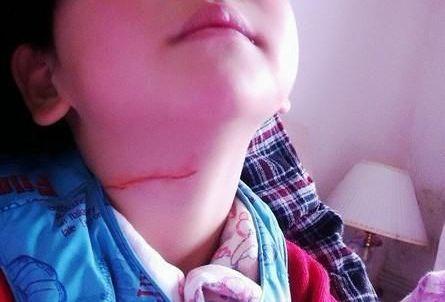 春季出游,小心隐形"割喉"杀手:风筝线