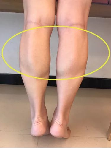 记住这几点,还你又细又直的大长腿!