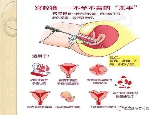 健康丨宫腔镜检查知多少