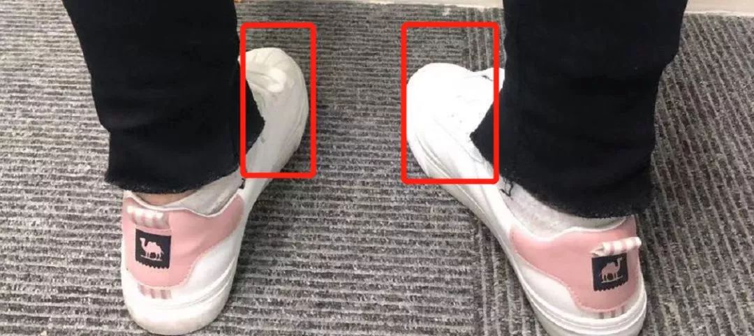 2个日常动作纠正你的内八脚或外八脚