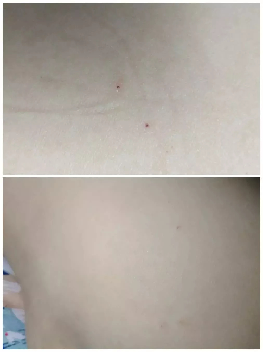 幼儿园被曝针扎幼儿,派出所长真的支招"拿钱摆平"?| 新京报快评