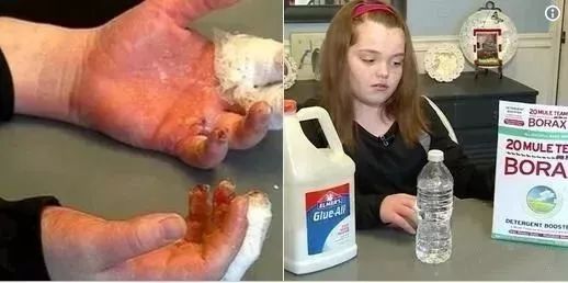 【生活提醒】小心孩子中毒!这种"水晶泥"玩具含致命毒硼砂!