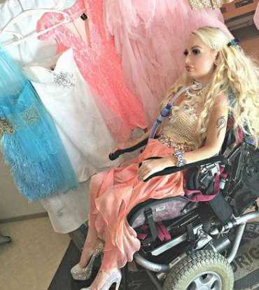 芬兰女子从小四肢瘫痪,靠模仿"芭比娃娃"找回生活乐趣!