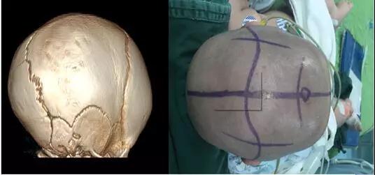 寿星头三角头等宝宝歪头真不是天赋异禀 可能是大麻烦