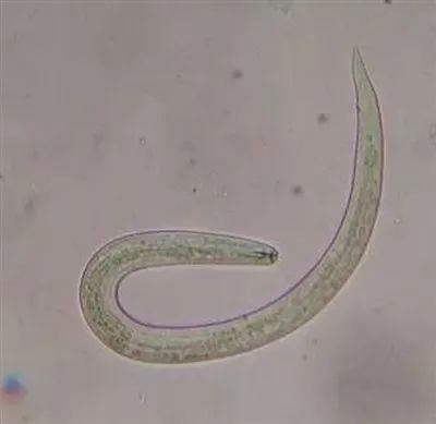 有这些行为赶紧停止|南方医科大学|蜈蚣|线虫_新浪新闻