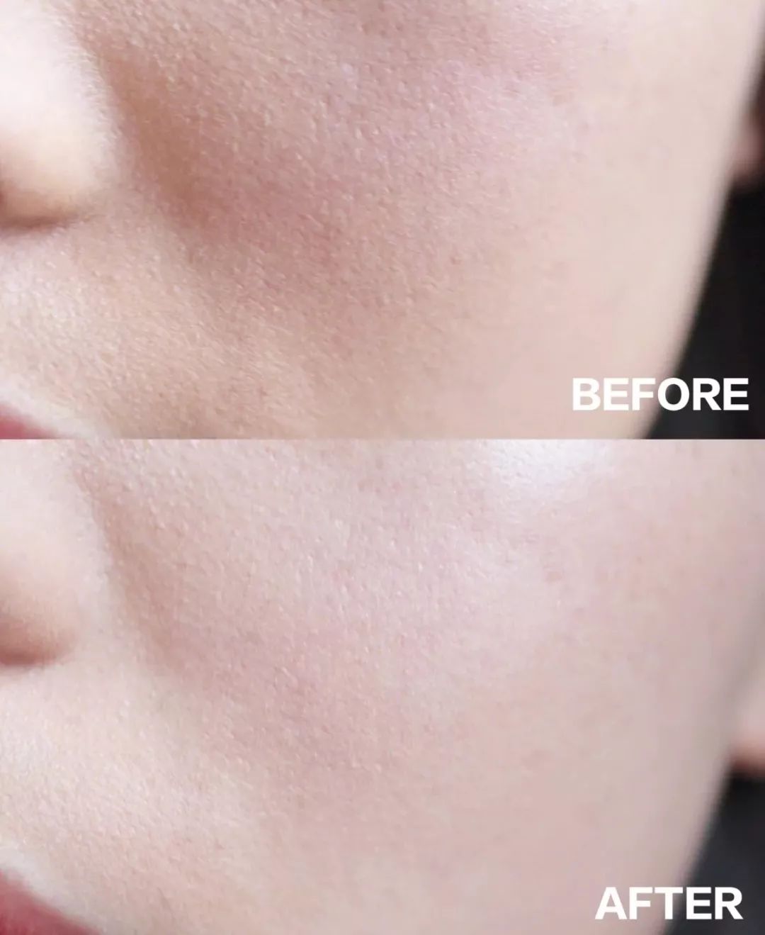 护肤品|去角质_新浪新闻