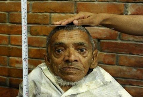 马加尔身高只有66厘米,他患有的也是一种原始侏儒症.