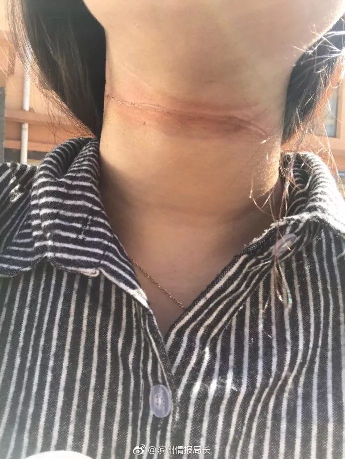 滨州一姑娘险被当街"割喉"!伤口触目惊心