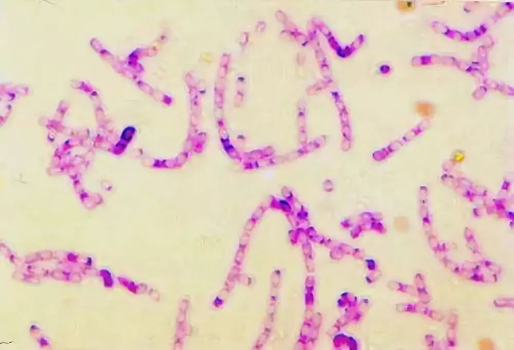 黑龙江发现疑似羊炭疽疫情会不会传染人知道这些就够了