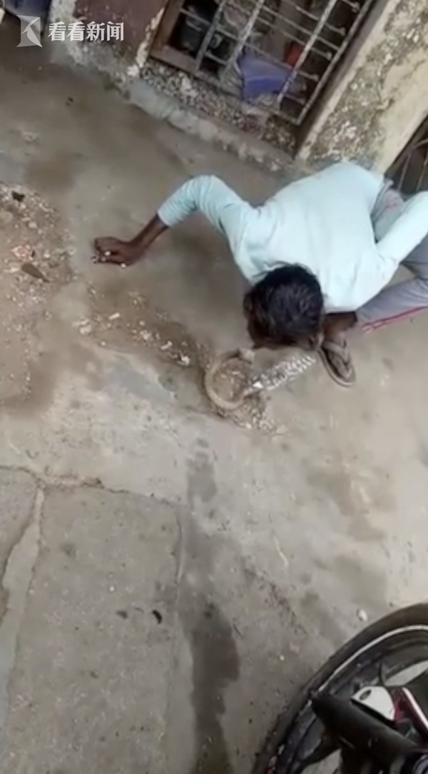 印度男子模仿网络视频亲吻眼镜蛇被咬成香肠嘴