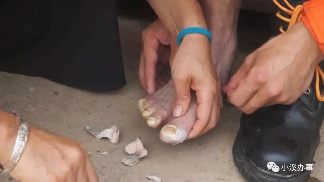 绷带缠十个脚趾,消防队员依然忍痛投入抗洪救灾