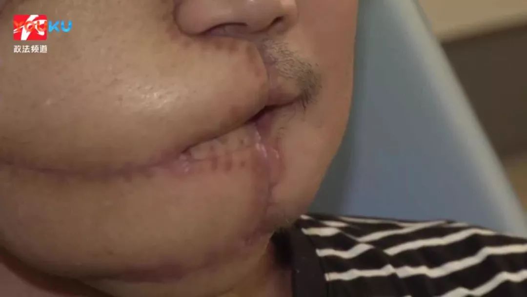 千亿"软性毒品"槟榔,和正在上瘾的6000万中国人