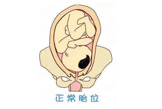 分娩交流:胎儿臀位该如何选择分娩方式?一定要剖腹产吗?