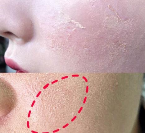 女人化妆卡粉好尴尬别急做到这3点让你远离脸部浮粉更自信